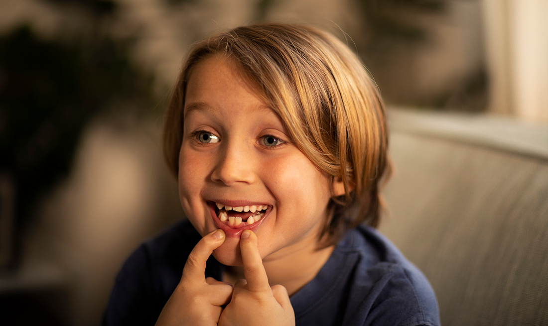 Pojke visar tänderna