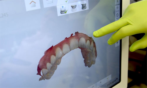 Digital teknik öppnar möjligheter till en mer effektiv och bekväm tandvård för kunderna. 