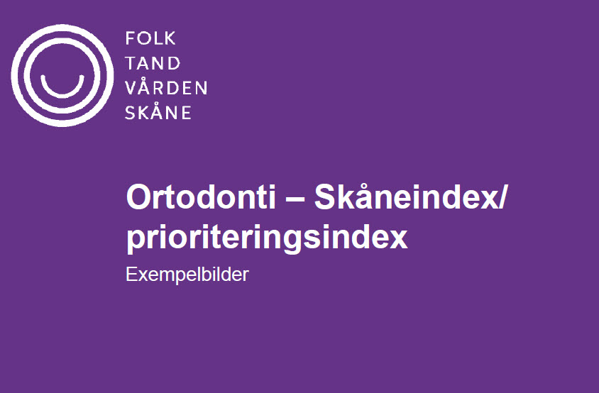 Skåneindex -bildexempel ortodonti inför visning